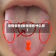 疫情舌苔(新冠舌苔什么样)